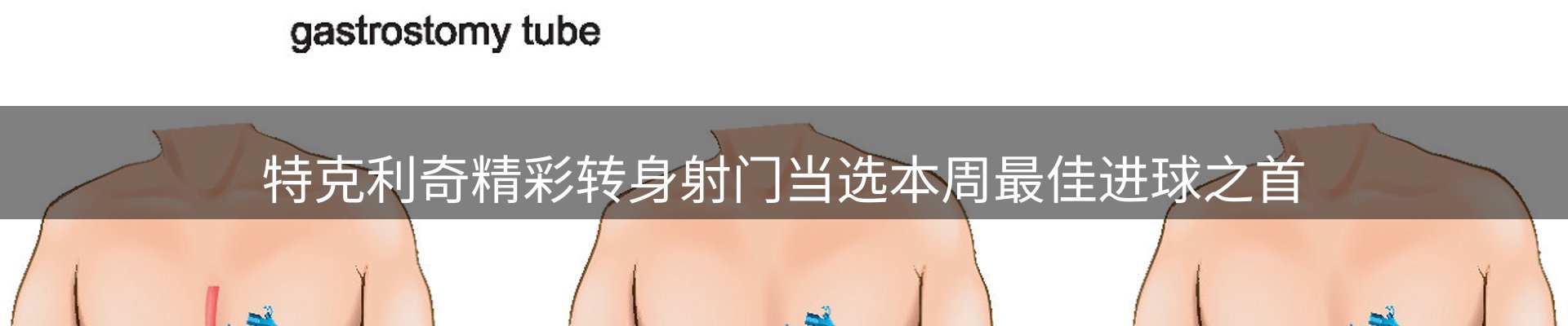 焦点概览